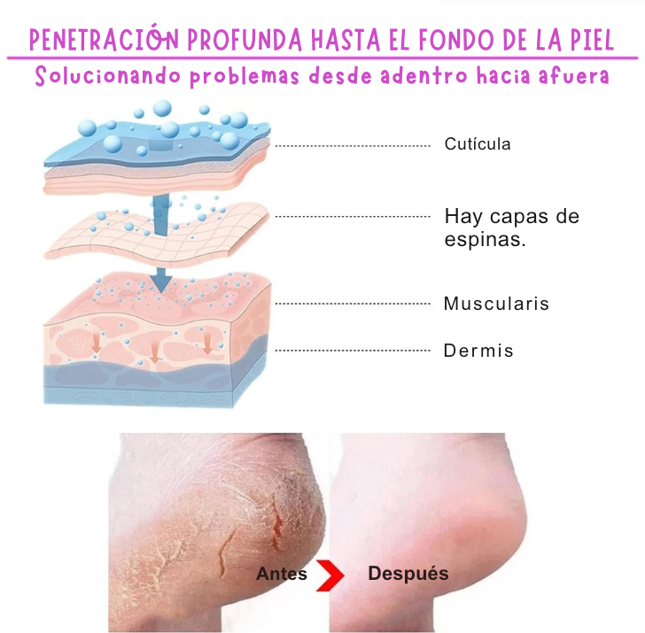 Exfoliante para pies, elimina callos e piel muerta. Reparación de grietas en el talón, calcetines para pedicura, cuidado de la piel del pie