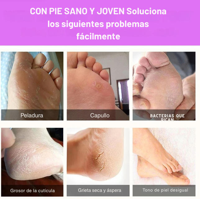 Exfoliante para pies, elimina callos e piel muerta. Reparación de grietas en el talón, calcetines para pedicura, cuidado de la piel del pie