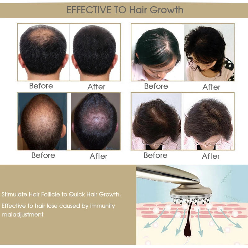 Masajeador láser RF para el crecimiento del cabello