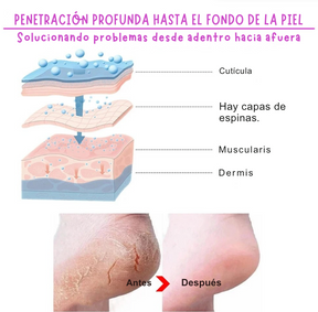 Exfoliante para pies, elimina callos e piel muerta. Reparación de grietas en el talón, calcetines para pedicura, cuidado de la piel del pie
