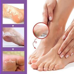 Exfoliante para pies, elimina callos e piel muerta. Reparación de grietas en el talón, calcetines para pedicura, cuidado de la piel del pie