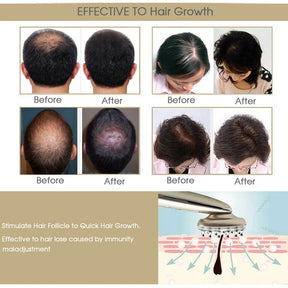 Masajeador láser RF para el crecimiento del cabello